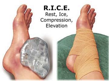 First Aid Sa Pamamaga Ng Paa .
